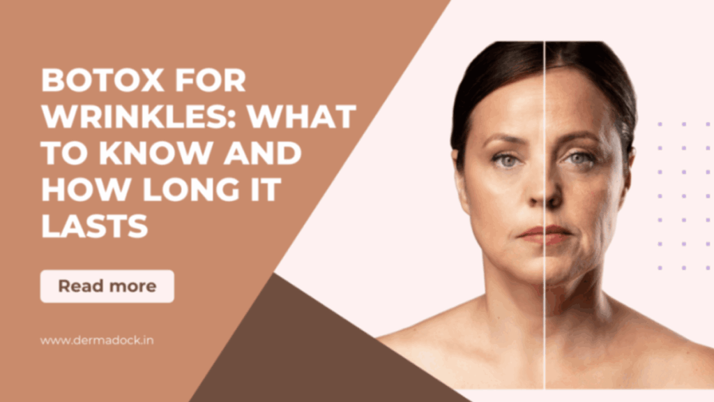 Botox for Wrinkles: What to Know and How Long It Lasts